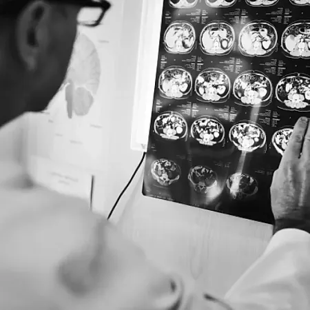 Различия опухолей: доброкачественные и злокачественные