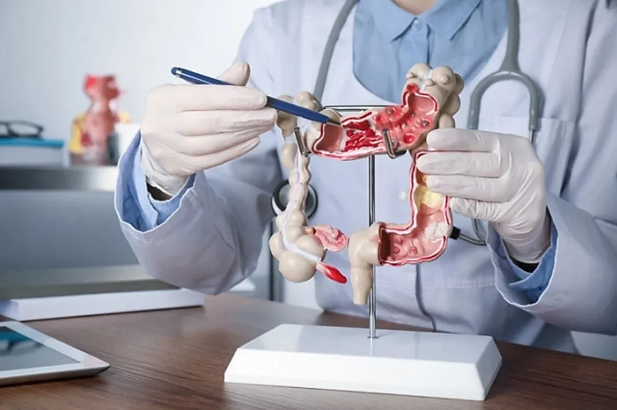 Проблемы с кишечником и их причины