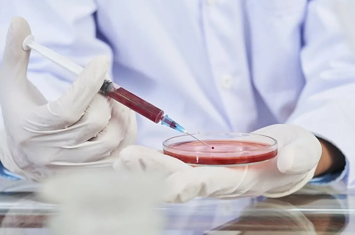 Опасность марбургской геморрагической лихорадки