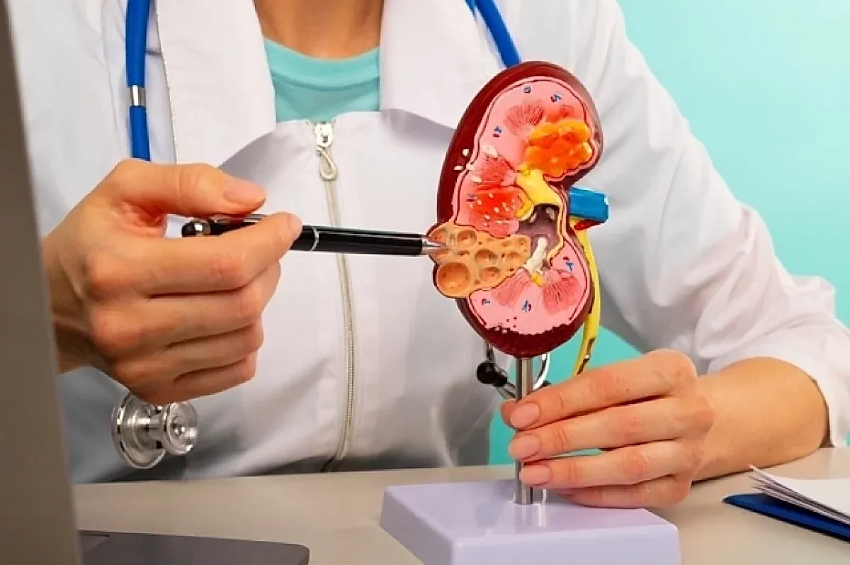 Связь COVID-19 с поражением почек