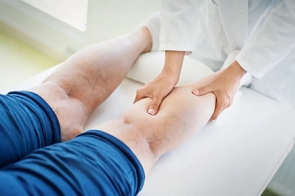 Влияние сидячей работы на варикоз