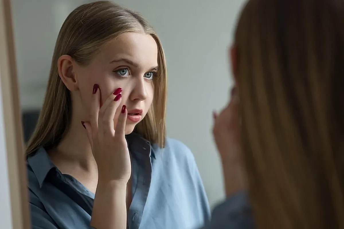 Розацеа: симптомы и лечение