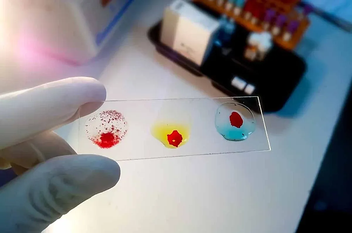 Молодая кровь и Альцгеймер