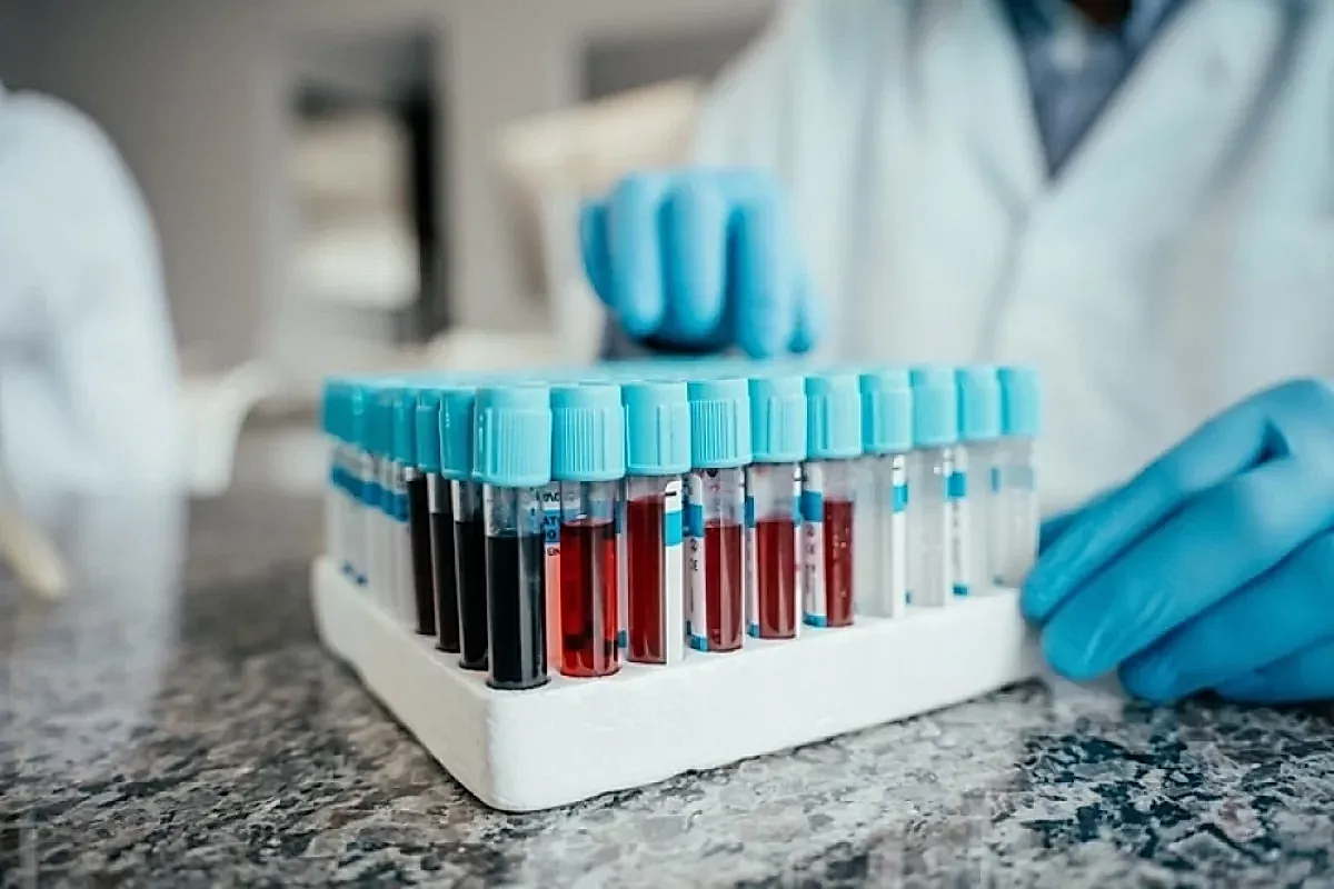Когда сдавать анализы крови и что важно знать