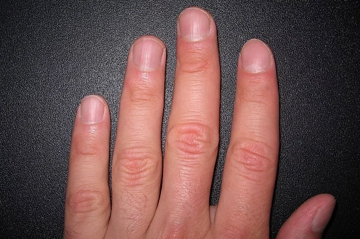 Цвет ногтей и здоровье