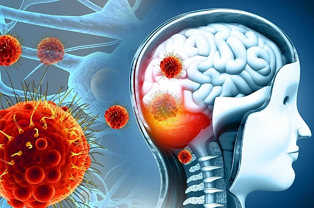 Вирус Нипах и защита от него