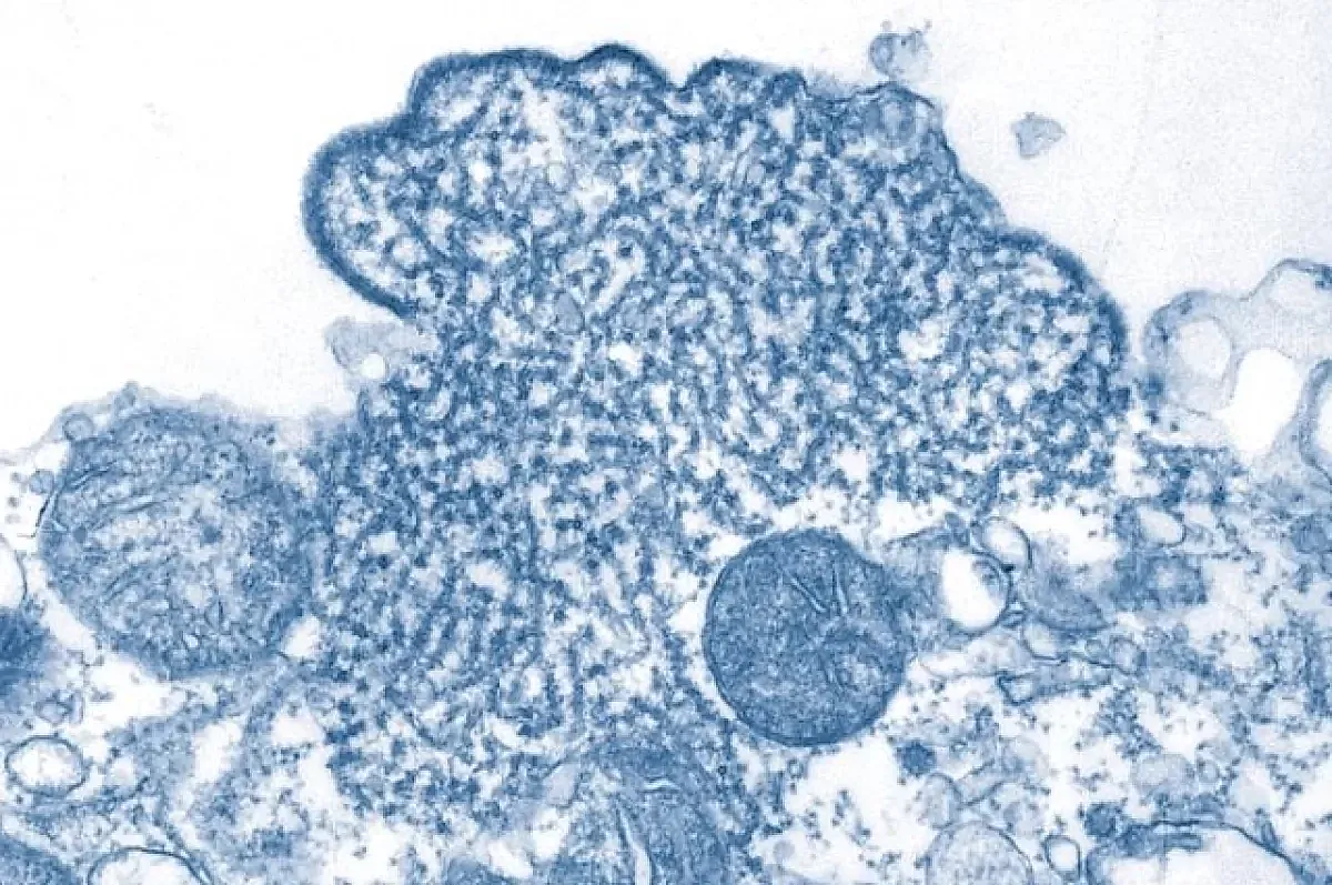 Вирус Нипах и грипп