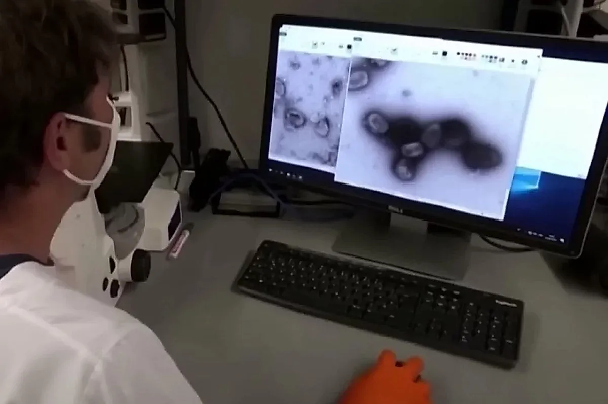 Оспа обезьян в России: факты о вирусе и методах защиты