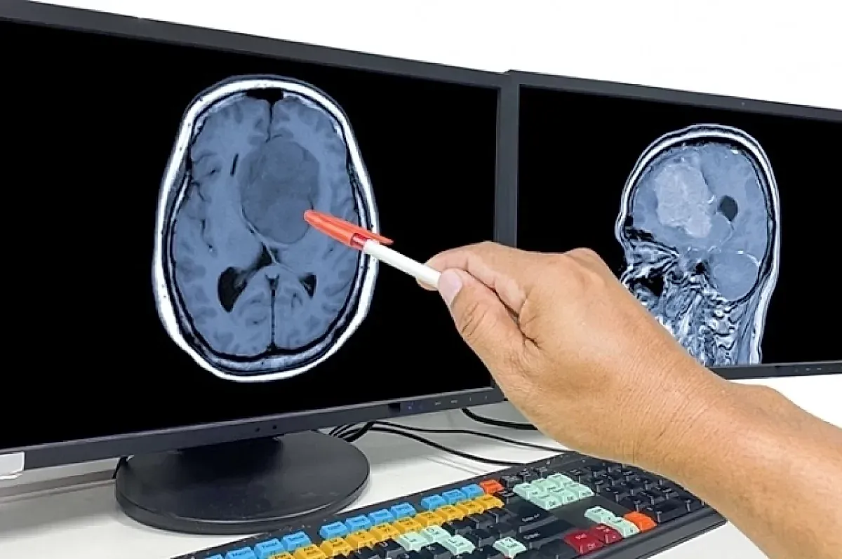 Здоровье мозга и движение